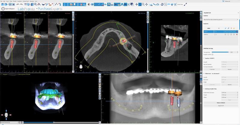 Computerized Surgical Planning in Newaygo